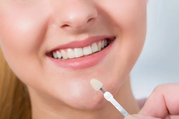 Закрыть использование направляющей тени во рту женщины, чтобы проверить шпон зубов для отбеливания — стоковое фото