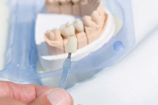 Zbliżenie Przewodnika Cienia Celu Sprawdzenia Nowego Uzębienia Odcisku Dentystycznym Laboratorium — Zdjęcie stockowe