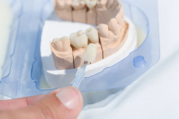 Diş laboratuarındaki bir diş izinin yapay dişlerini kapatın.
