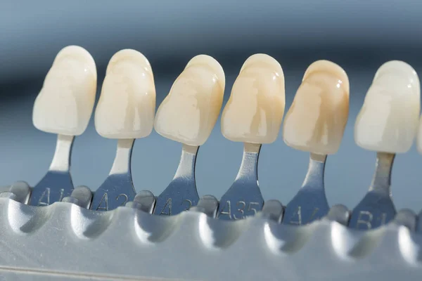 Close Shade Guide Check Veneer Tooth Crown Dental Laboratory — Stock Photo, Image