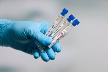 Virüs analizinden sonra test tüplerini tutan mavi eldivenleri laboratuvar odasının önünde gösteren işaretlerle teslim edin.