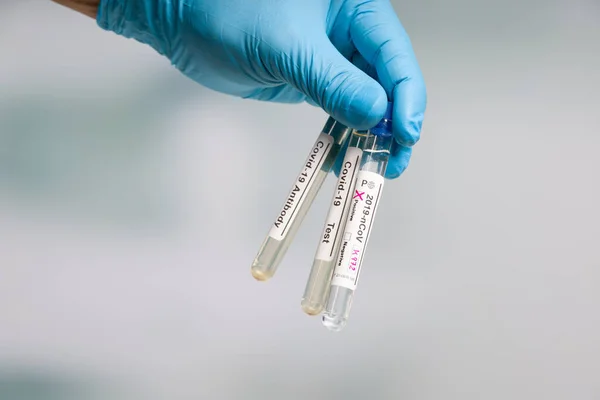 Hand Blue Gloves Holding Three Test Tubes Virus Analysis Result — Stock Photo, Image