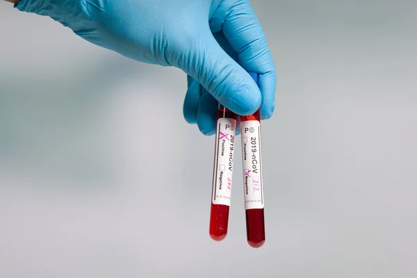 Hand Blue Gloves Holding Test Tubes Virus Analysis Result Markers — Stock Photo, Image