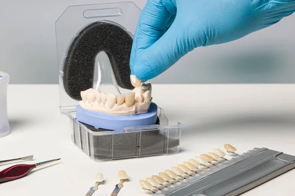 Diş Laboratuarında Hazır Bir Yapay Diş — Stok fotoğraf