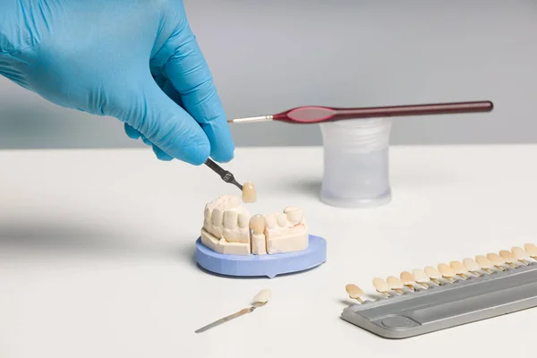 Diş Kaplamasını Kontrol Diş Laboratuarına Gölge Rehberi Yerleştir — Stok fotoğraf