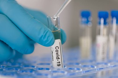 Coronavirus test küvetine elinizi sokun.