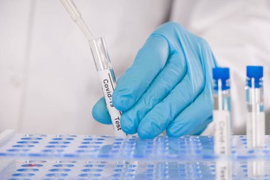 Coronavirus test tüpünü tutan tıbbi eldivenleri giyin.