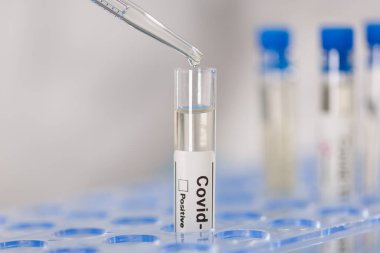 Coronavirus test tüpünü dolduran pipeti kapat