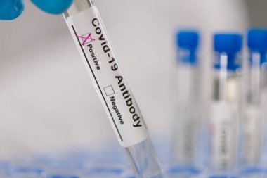 Ellerinizi mavi eldivenlerle kapatın ve virüs analizinden sonra tüp tutarak (antikor) test sonuçlarına bakın.