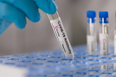 Elinizi tıbbî eldivenlerle kapatın. Coronavirus test küvetini kontrol edin.