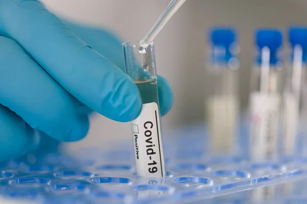 Coronavirus test küvetine elinizi sokun.