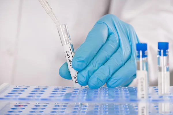 Coronavirus test tüpünü tutan tıbbi eldivenleri giyin.