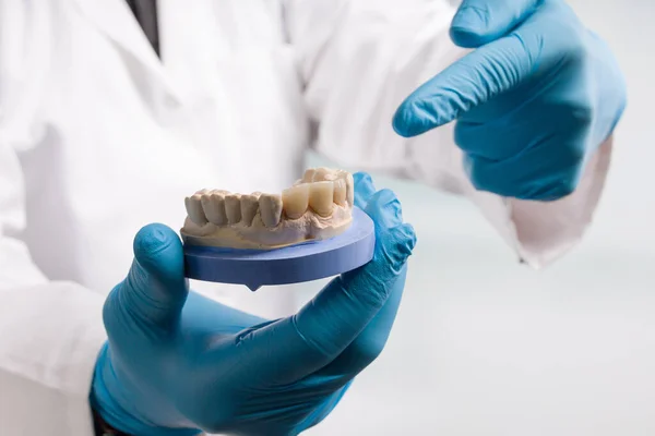 Diş Teknisyeninin Eldiveni Kullanıma Hazır Yapay Dişli Bir Diş Izi — Stok fotoğraf