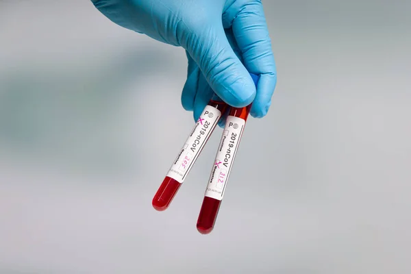 Close Hands Blue Gloves Holding Two Blood Test Tubes Virus — Stock Photo, Image