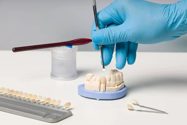 Diş Laboratuarında Takma Diş Parçaları Üzerinde Çalışmayı Kapat — Stok fotoğraf