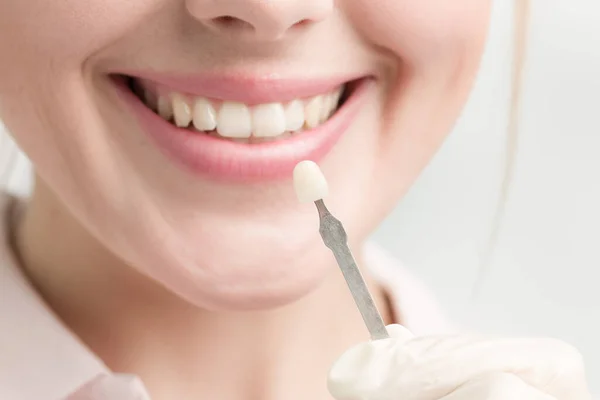 Close Dentist Using Shade Guide Woman Mouth Check — Stock Photo, Image