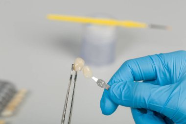 Diş kaplamasını kontrol et ya da bir sha ile implante et.