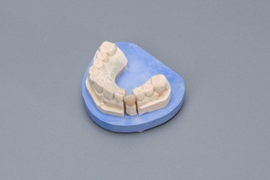 Kıç taraftaki yapay dişçide kullanıma hazır bir konumu kapat