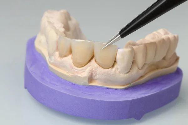 Крупним Планом Деталі Працюють Зубних Частинах Стоматологічному Лабораторії — стокове фото