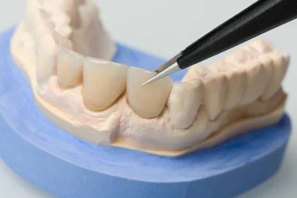 Diş Laboratuarındaki Takma Dişler Üzerinde Çalışırken Detaylara Dikkat — Stok fotoğraf