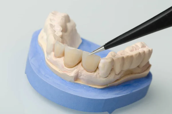 Diş Laboratuarındaki Takma Dişler Üzerinde Çalışırken Detaylara Dikkat — Stok fotoğraf