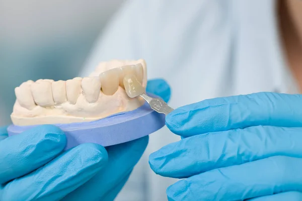 Diş Kaplamasını Kontrol Bir Sha Ile Implante — Stok fotoğraf