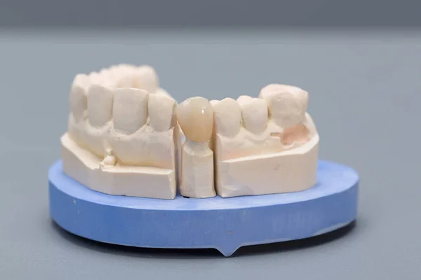 Primo Piano Della Manipolazione Pronto Uso Poppa Dentizione Artificiale — Foto Stock