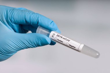 Mavi eldivenler içinde, laboratuarın önünde boş bir test tüpü tutuyorlar.