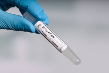 Mavi eldivenler içinde, laboratuarın önünde boş bir test tüpü tutuyorlar.