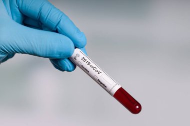 Bir laboratuarın önünde elinde kan testi tüpü tutan mavi eldivenler. 
