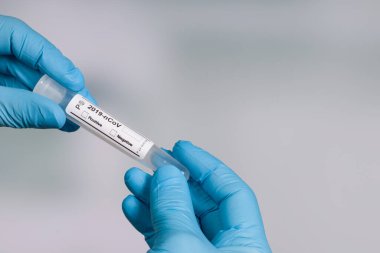 Elinde matarayla Coronavirus araştırma konsepti