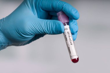 Bir laboratuarın önünde elinde kan testi tüpü tutan mavi eldivenler. 