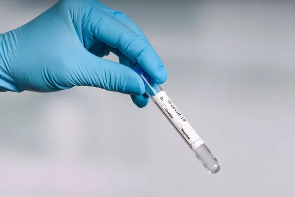 Mano Guantes Azules Sosteniendo Tubo Ensayo Vacío Delante Laboratorio — Foto de Stock