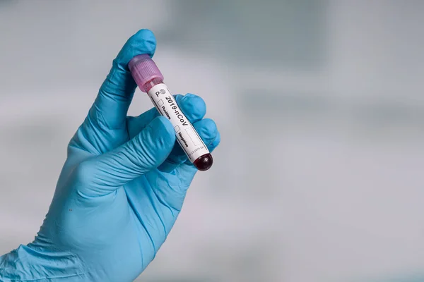 Mão Luvas Azuis Segurando Tubo Teste Sangue Frente Laboratório — Fotografia de Stock