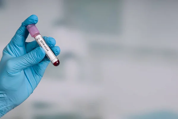 Hand Blå Handskar Med Ett Blodprovsrör Framför Ett Labb — Stockfoto