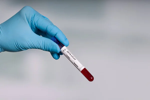 Mão Luvas Azuis Segurando Tubo Teste Sangue Frente Laboratório — Fotografia de Stock