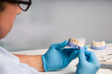 Diş teknisyeninin kaplamasını diş laboratuarında kontrol ederken yakın plan.