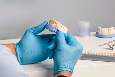 Diş teknisyeninin kaplamasını diş laboratuarında kontrol ederken yakın plan.