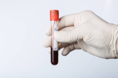 Kan örneğiyle birlikte doktorun eli.