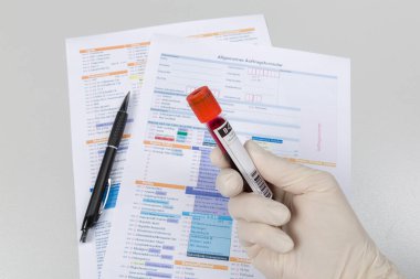 Kan sondasıyla doktorun eli ve analiz için form talebi.