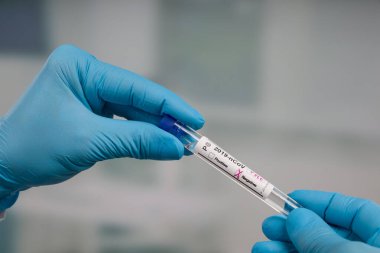 Virüs analizinden sonra elinde test tüpü tutan mavi eldivenleri teslim et.
