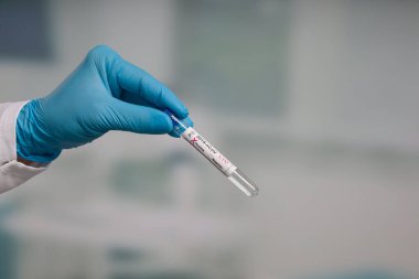 Virüs analizinden sonra elinde test tüpü tutan mavi eldivenleri teslim et.
