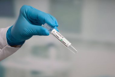 Virüs analizinden sonra elinde test tüpü tutan mavi eldivenleri teslim et.