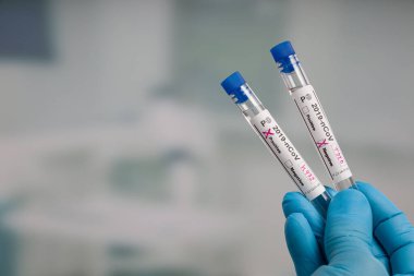 Virüs analizinden sonra laboratuvar odasının önünde iki test tüpü tutan mavi eldivenleri teslim edin. 