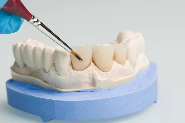 在牙科化验室用牙刷在假牙上完成粉刷工作 — 图库照片