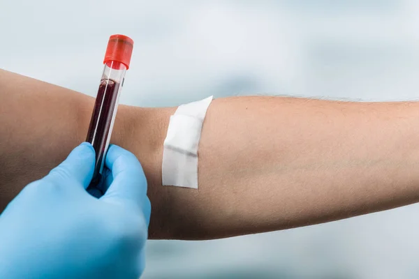 stock image after taking of blood: blood probe and arm with adhesive tape 