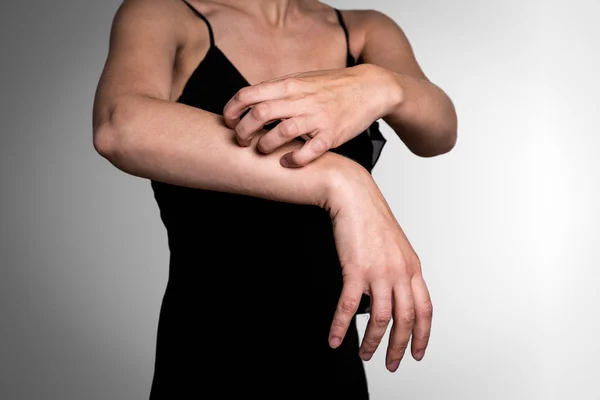 Vrouw krassen jeukende huid op handen — Stockfoto