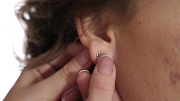 Mujer con la cara de acné cicatrizado pone un pendiente en su oído — Vídeo de stock