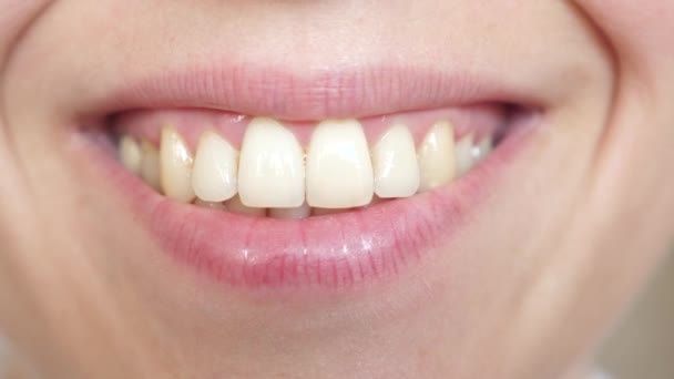 Feche com um belo sorriso de uma jovem. menina sorrindo dentes e lábios close-up . — Vídeo de Stock