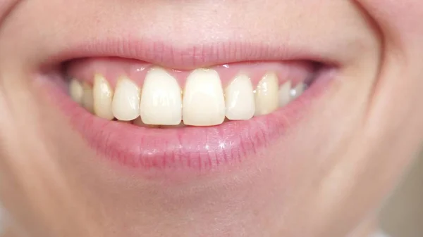 dudaklar Kiss yakın çekim. Genç bir kadının güzel bir gülümseme. Kız gülümseyen diş ve dudaklar yakın çekim.